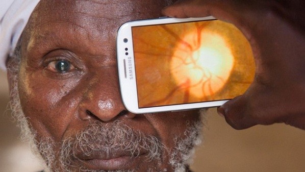 تطبيق ذكي جديد يبشر بتسهيل إجراء فحوصات العين في جميع أنحاء العالم