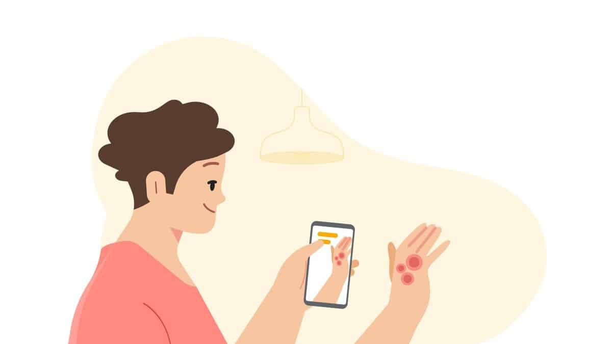 أداة Google Lens تساعد الآن في تشخيص الأمراض الجلدية