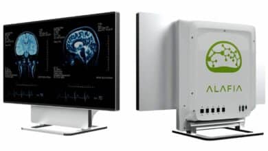 Alafia تقدم حاسوبًا متكاملًا لأجهزة التصوير الطبي بقوة معالجة مذهلة
