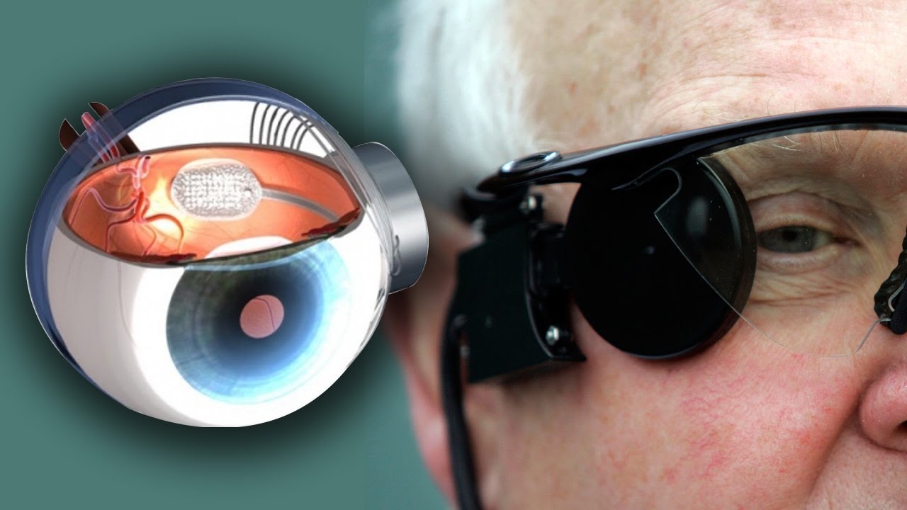 "العين الإلكترونية": فرصة جديدة للمصابين بالعمى